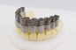 Impresora dental de Dual Fiber Laser Digital los 20-60μM Crowns And Dentures 3D de la impresora de la FCC 3D