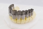 Sola industria de For Dental Jewelry de la impresora del metal del laser 3D de la fibra