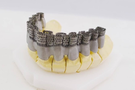Impresora Special Printing Equipment de Riton Dental 3D para la corona interna fundida de cerámica del metal